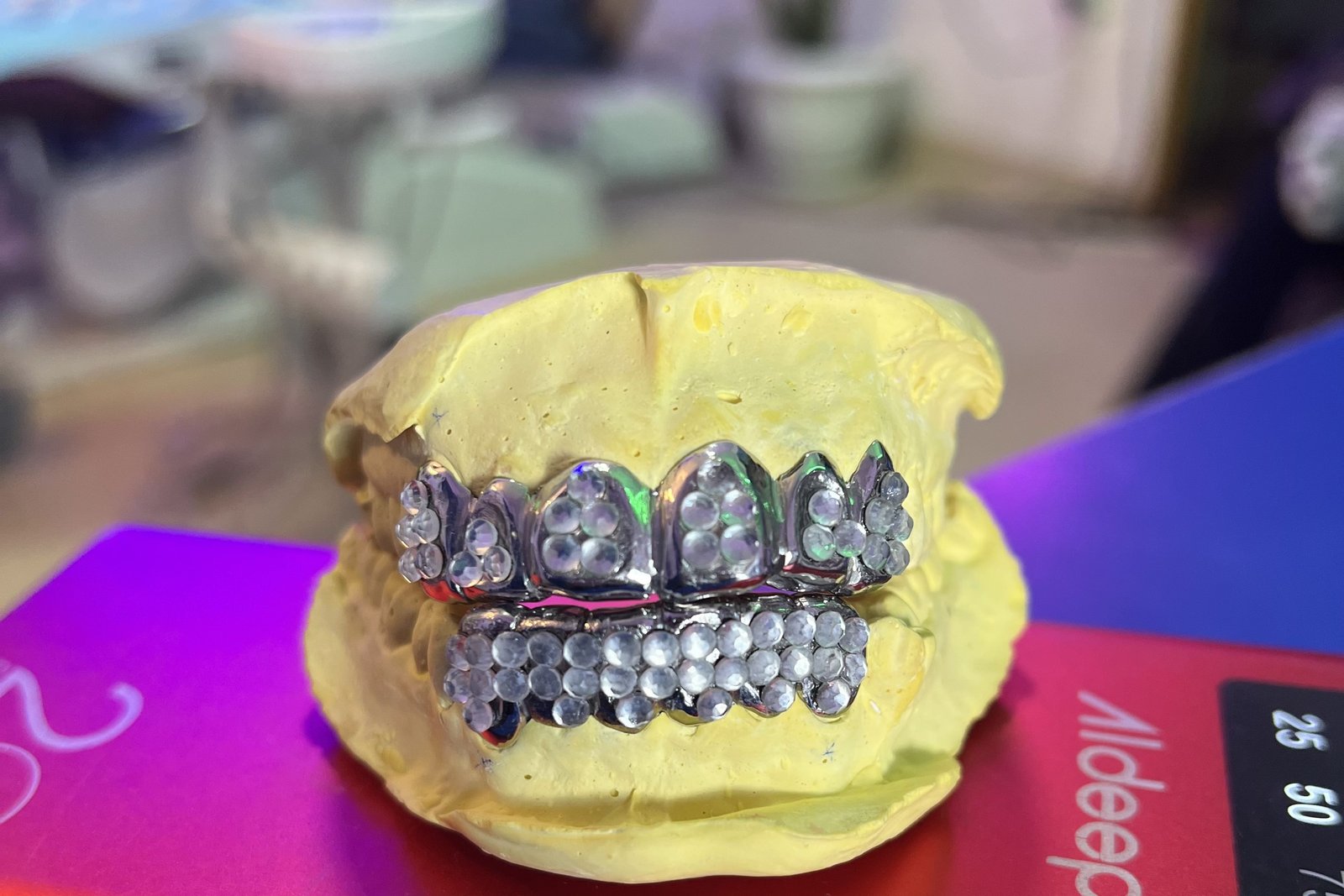 Custom dental grill at Piwan Dental