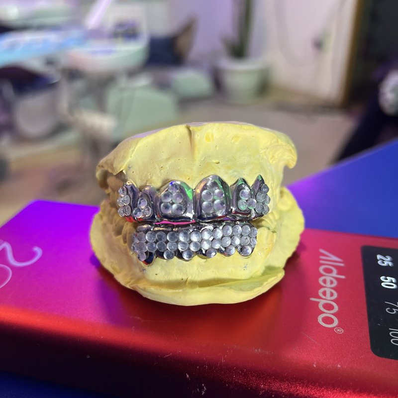 Custom diamond-studded dental grill at Piwan Dental, Gulu